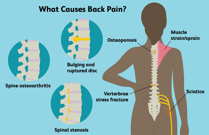Back-Pain