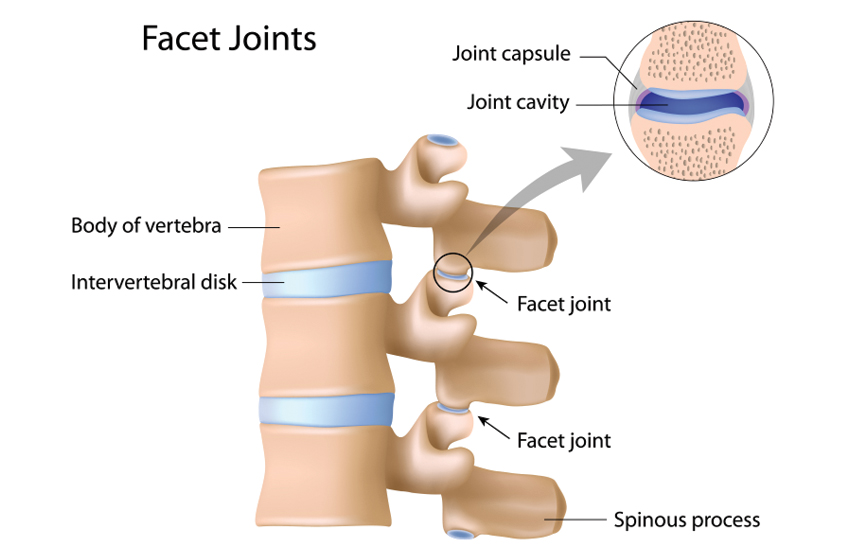 Facet joint injections